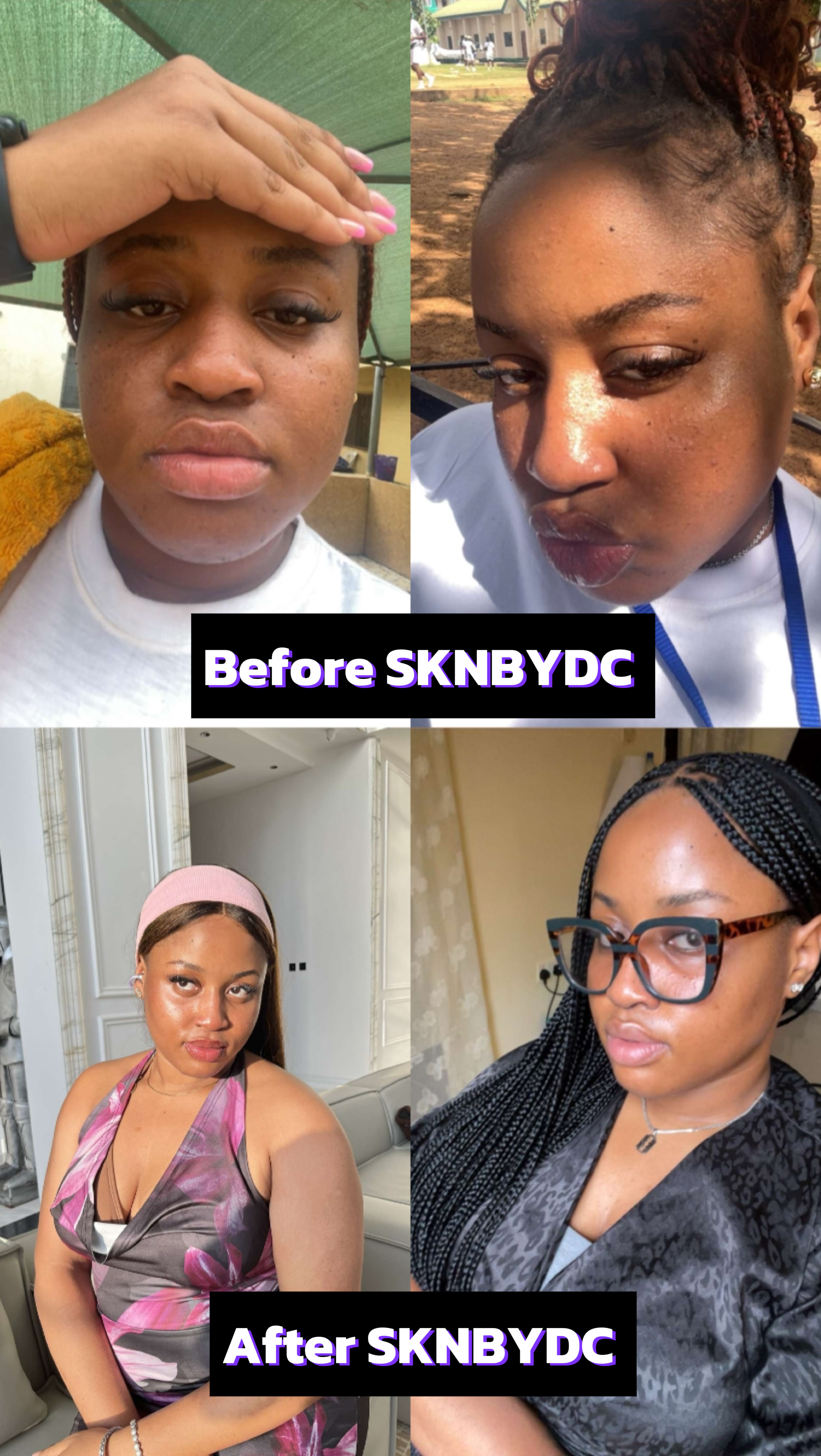 Clear Skin Transformation