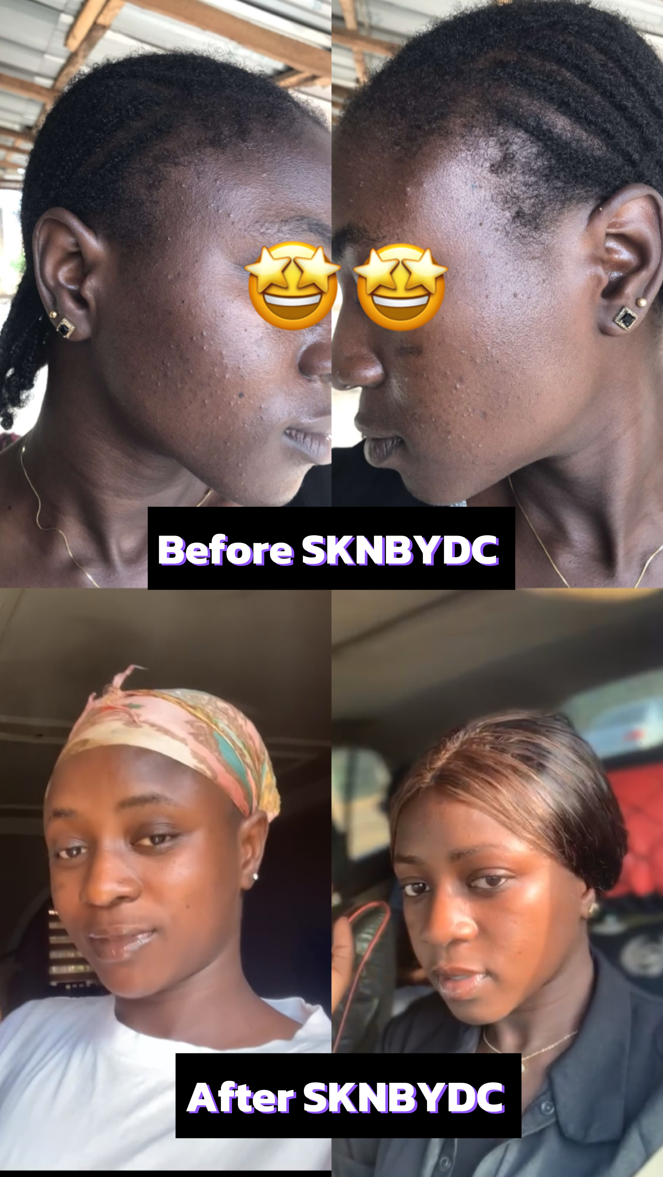 Glowing Skin Results
