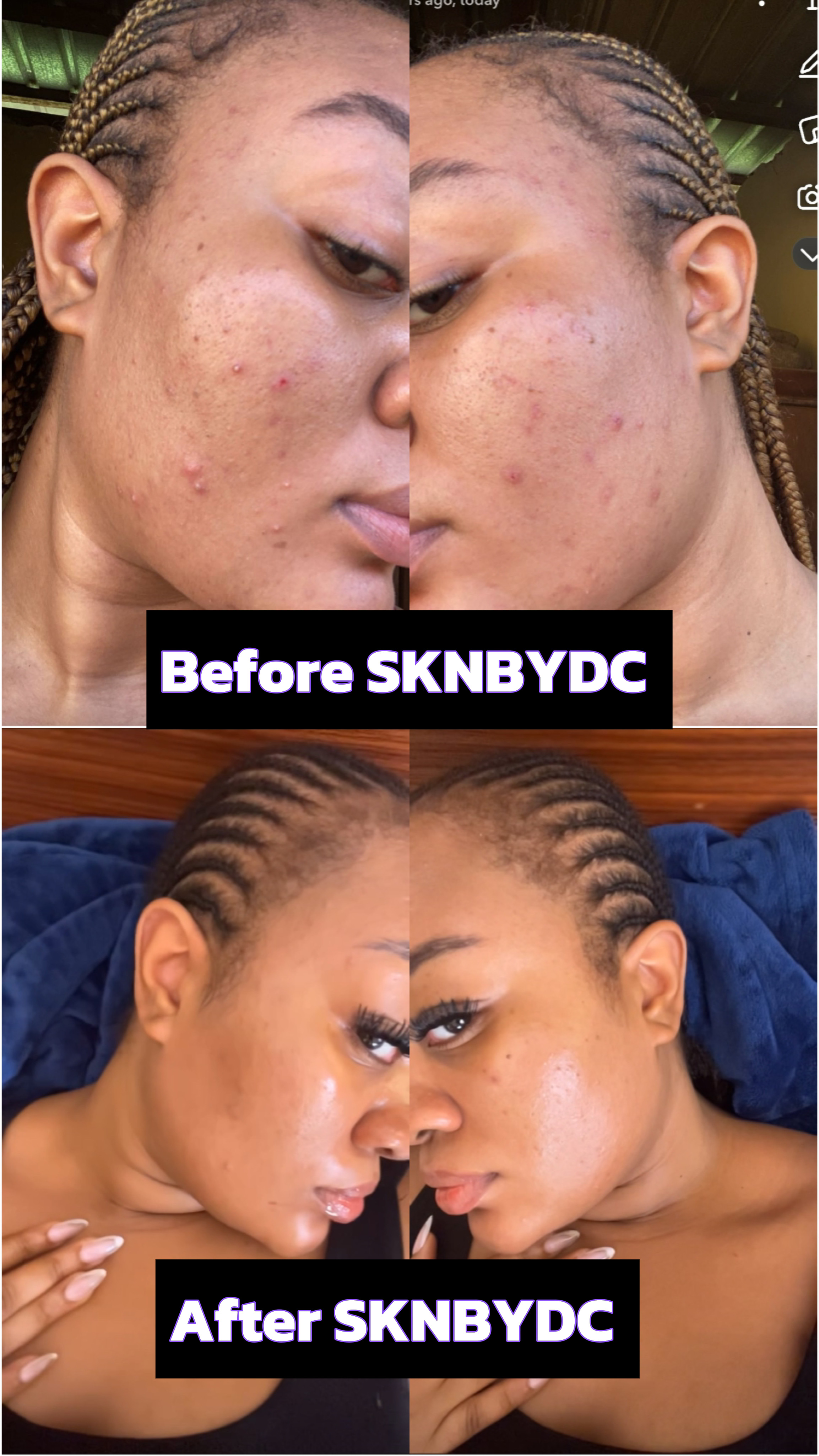 Smooth & Clear Complexion